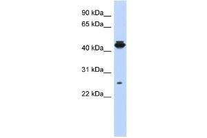 WB Suggested Anti-PDIK1L Antibody Titration: 0. (PDIK1L Antikörper  (Middle Region))