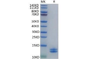 Human Calprotectin (S100A8&S100A9) on Tris-Bis PAGE under reduced condition. (Calprotectin Protein (S100A8/A9) (His tag))