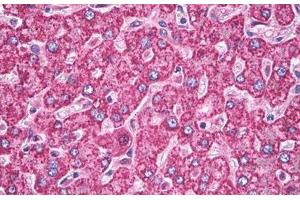 Image no. 3 for anti-Superoxide Dismutase 2, Mitochondrial (SOD2) antibody (ABIN1496289) (SOD2 Antikörper)