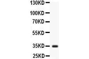 Observed bind size: 35KD (Liver Arginase Antikörper  (N-Term))
