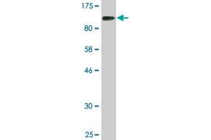 Western Blot detection against Immunogen (85. (CHEK2 Antikörper  (AA 1-543))