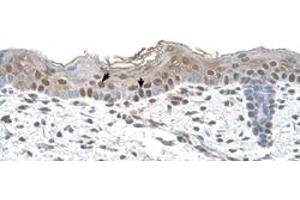 Immunohistochemical staining (Formalin-fixed paraffin-embedded sections) of human skin with ARRB2 polyclonal antibody  at 4-8 ug/mL working concentration. (Arrestin 3 Antikörper  (Internal Region))