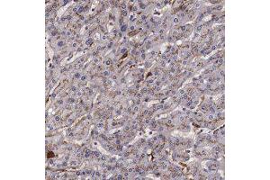 Immunohistochemical staining of human liver with APOH polyclonal antibody  shows moderate cytoplasmic positivity, with a granular pattern, in hepatocytes. (APOH Antikörper)