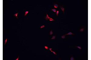 ABIN6266881 staining HeLa cells by IF/ICC. (HDAC5 Antikörper  (C-Term))