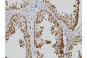 Image no. 4 for anti-DEAD (Asp-Glu-Ala-Asp) Box Polypeptide 6 (DDX6) (AA 1-484) antibody (ABIN598641) (DDX6 Antikörper  (AA 1-484))