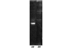 Western blot analysis: Luminograph of a HeLa S3 cytosol preparation after SDS PAGE followed by blotting onto PVDF membrane and probing with (a) antibody  and (b) antibody  pre-absorbed with cognate peptide. (COP9 Signalosome Csn6 Subunit (AA 283-297) Antikörper)