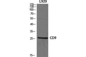 Western Blot (WB) analysis of specific cells using CD9 Polyclonal Antibody. (CD9 Antikörper  (Internal Region))