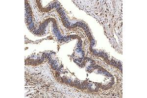 IHC analysis of Syntenin 2/SDCBP2 using anti-Syntenin 2/SDCBP2 antibody (ABIN7600017). (SDCBP2 Antikörper  (AA 14-292))