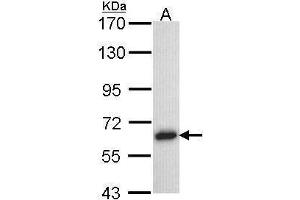WB Image Sample (30 ug of whole cell lysate) A: Hela 7. (TRAF5 Antikörper  (N-Term))