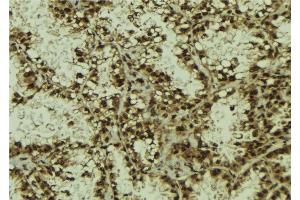 ABIN6278396 at 1/100 staining Human lung tissue by IHC-P.
