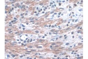 IHC-P analysis of Mouse Uterus Tissue, with DAB staining. (ITGA3 Antikörper  (AA 33-236))