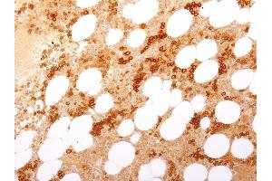Formalin-fixed, paraffin-embedded Human Bone Marrow stained with CD71 Rabbit Recombinant Monoclonal Antibody (TFRC/2898R). (Rekombinanter Transferrin Receptor Antikörper  (Extracellular Domain))
