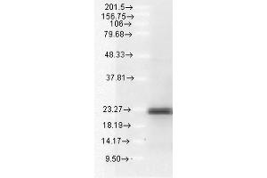 Western blot analysis of Human A549 cell lysates showing detection of BIM protein using Rabbit Anti-BIM Polyclonal Antibody . (BIM Antikörper  (APC))