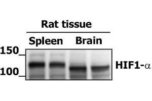 Image kindly submitted by Edita Aksamitiene as part of the Free Sample Program. (HIF1A Antikörper  (AA 341-450))