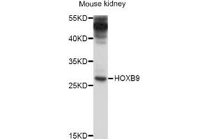 Western blot analysis of extracts of mouse kidney, using HOXB9 antibody (ABIN4903958) at 1:1000 dilution. (HOXB9 Antikörper)