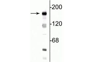 Western blot of 10  µg of rat hippocampal lysate showing specific immunolabeling of the ~180 kDa NR2B subunit of the NMDA receptor.