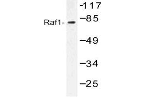 Western blot analysis of RAF1 Antibody in extracts from HT-29 cells. (RAF1 Antikörper)