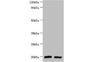 Western blot All lanes: Peptidyl-tRNA hydrolase 2, mitochondrial antibody at 4 μg/mL Lane 1: MM231 whole cell lysate Lane 2: Jurkat whole cell lysate Secondary Goat polyclonal to rabbit IgG at 1/10000 dilution Predicted band size: 19 kDa Observed band size: 19 kDa (PTRH2 Antikörper  (AA 40-179))