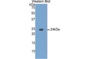 Western blot analysis of the recombinant protein. (IGFBP6 Antikörper  (AA 51-226))