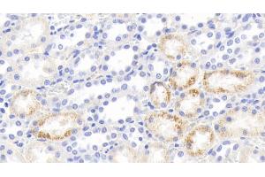 Detection of IFNg in Rabbit Kidney Tissue using Polyclonal Antibody to Interferon Gamma (IFNg) (Interferon gamma Antikörper  (AA 24-167))