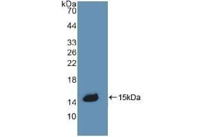 Detection of Recombinant CBG, Rat using Polyclonal Antibody to Corticosteroid Binding Globulin (CBG) (SERPINA6 Antikörper  (AA 267-390))