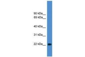 Image no. 1 for anti-Nudix (Nucleoside Diphosphate Linked Moiety X)-Type Motif 16-Like 1 (NUDT16L1) (AA 78-127) antibody (ABIN6745492) (NUDT16L1 Antikörper  (AA 78-127))