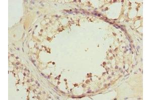 Immunohistochemistry of paraffin-embedded human testis tissue using ABIN7167216 at dilution of 1:100 (RRAS2 Antikörper  (AA 1-204))