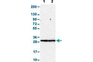 Western Blot analysis with FCGR3A polyclonal antibody . (FCGR3A Antikörper  (AA 227-254))