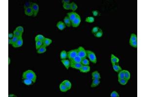 Immunofluorescent analysis of PC-3 cells using ABIN7162269 at dilution of 1:100 and Alexa Fluor 488-congugated AffiniPure Goat Anti-Rabbit IgG(H+L) (ORC4 Antikörper  (AA 1-436))