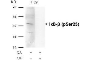 Western blot analysis of extracts from HT29 cells, treated with CA or calf intestinal phosphatase (CIP), using IκB-β (Phospho-Ser23) Antibody. (NFKBIB Antikörper  (pSer23))