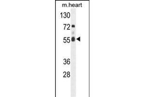 Western blot analysis of hFASTK- (ABIN391120 and ABIN2841247) in mouse heart tissue lysates (35 μg/lane). (FASTK Antikörper  (C-Term))