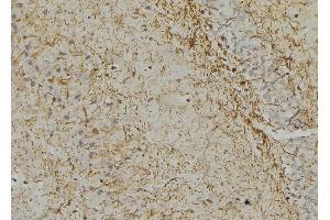 ABIN6256306 and ABIN6267377 at 1/100 staining mouse brain tissue by IHC-P.