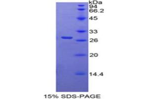 SDS-PAGE analysis of Mouse RARa Protein. (Retinoic Acid Receptor alpha Protein)