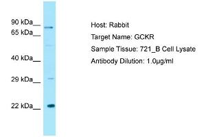 Host: RabbitTarget Name: GCKRAntibody Dilution: 1. (GCKR Antikörper  (C-Term))