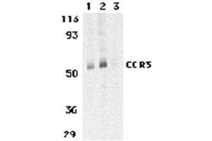 Western blot analysis of CCR3 in human spleen tissue lysates with AP30215PU-N CCR3 antibody at 1 (lane 1) and 2 μg/ml (lane 2), and 2 μg/ml in the presence of blocking peptide (lane 3). (CCR3 Antikörper  (C-Term))