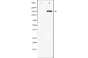 Western blot analysis of c-Met phosphorylation expression in HepG2 whole cell lysates,The lane on the left is treated with the antigen-specific peptide. (c-MET Antikörper  (pTyr1003))