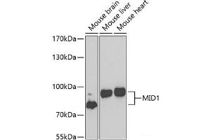 Western blot analysis of extracts of various cell lines using MID1 Polyclonal Antibody at dilution of 1:1000. (MID1 Antikörper)