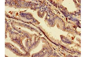Immunohistochemistry of paraffin-embedded human prostate tissue using ABIN7158740 at dilution of 1:100 (ACP6 Antikörper  (AA 35-324))