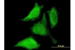 Immunofluorescence of purified MaxPab antibody to PROK1 on HeLa cell. (Prokineticin 1 Antikörper  (AA 1-105))