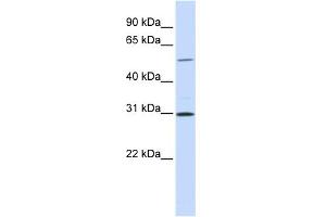 WB Suggested Anti-NEK3 Antibody Titration:  0. (NEK3 Antikörper  (N-Term))
