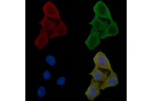 ABIN6260953 and ABIN6266991 staining Hela cells(30 min of UV treatment) by IF/ICC.