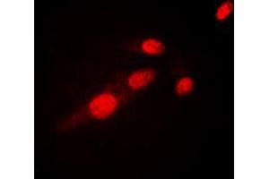 Immunofluorescent analysis of NF-kappaB p65 (AcK310) staining in HeLa cells. (NF-kB p65 Antikörper  (acLys310))