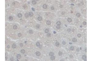 Detection of GFM1 in Mouse Liver Tissue using Polyclonal Antibody to G-Elongation Factor, Mitochondrial 1 (GFM1)
