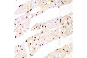 Immunohistochemistry of paraffin-embedded mouse heart using Nono Antibody (ABIN5973035) at dilution of 1/100 (40x lens). (NONO Antikörper)