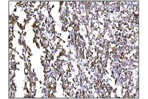 IHC analysis of Prolyl Endopeptidase/PREP using anti-Prolyl Endopeptidase/PREP antibody (ABIN7599118). (PREP Antikörper  (AA 1-227))