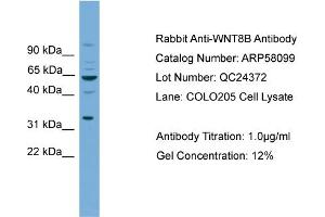 Western Blotting (WB) image for anti-Wingless-Type MMTV Integration Site Family, Member 8B (WNT8B) (N-Term) antibody (ABIN2787546)