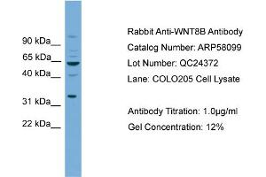 WB Suggested Anti-WNT8B  Antibody Titration: 0.