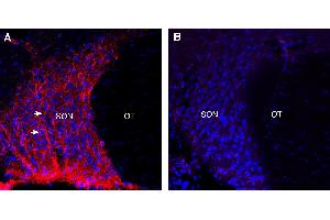Expression of Neuropeptide S Receptor in rat supraoptic nucleus (SON).