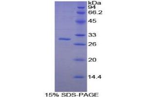 SDS-PAGE analysis of Mouse PAFAH1B3 Protein. (PAFAH1B3 Protein)
