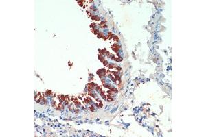 Immunohistochemistry of paraffin-embedded mouse lung using KIF5B antibody (ABIN7268136) at dilution of 1:200 (40x lens). (KIF5B Antikörper  (AA 650-770))